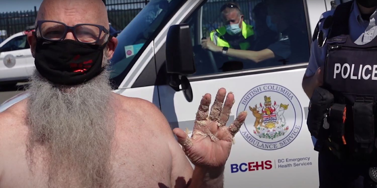 A light-skinned man with a long grey beard, shirtless and wearing a black mask over his mouth and nose, holds up a hand covered in remnants of beige-coloured glue. A police officer stands off to the side, in front of a vehicle with a British Columbia Ambulance Service logo.