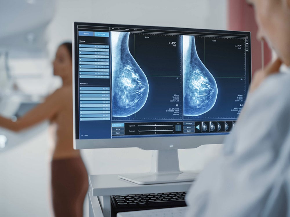 A computer monitor in the foreground shows mammogram results on a blue screen. They are being examined by a younger female doctor in a light blue lab coat. In the background in soft focus is a younger woman holding the handles of a breast cancer screening device.